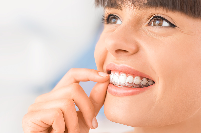 Invisalign in Middletown
