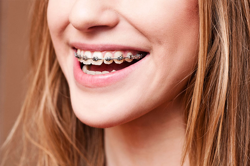 Orthodontics in Middletown