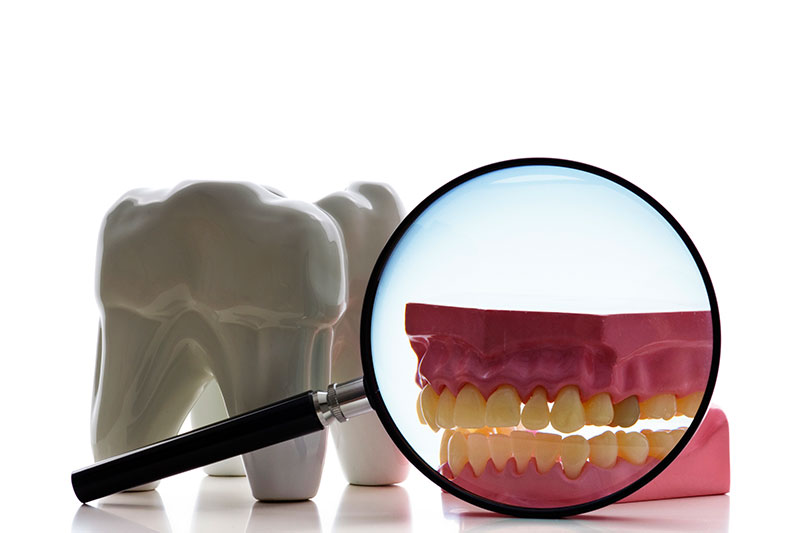 Root Canal in Middletown