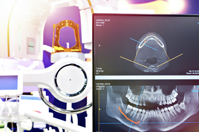 Digital X-Rays in Middletown