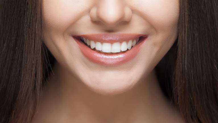 dental implants middletown | woman smiling