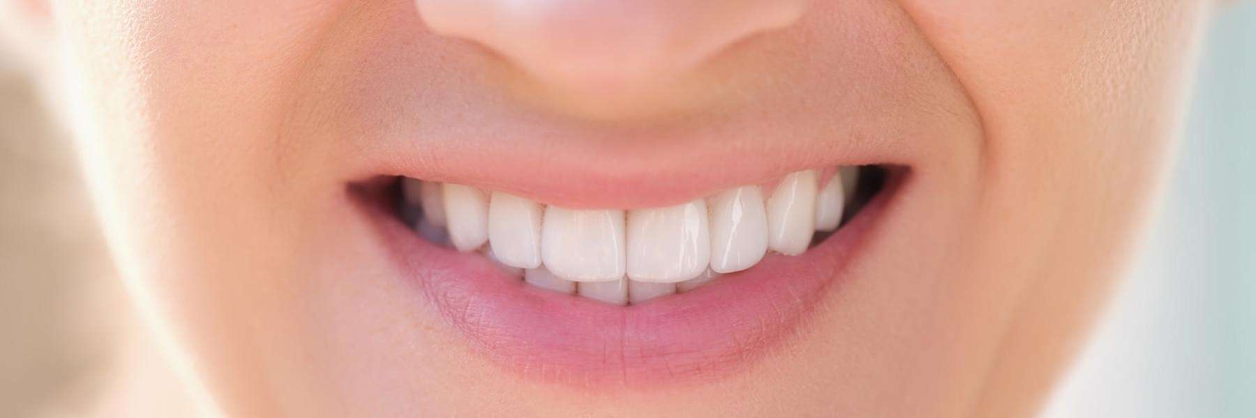 Close-up of a woman's smile showcasing white teeth, emphasizing the connection between orthodontics 
